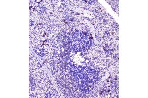 IHC analysis of RASAL1 using anti-RASAL1 antibody (ABIN6719367). (RASAL1 antibody  (AA 721-798))