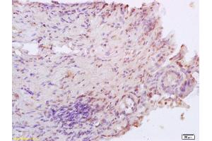 Formalin-fixed and paraffin embedded rat colitis labeled with Anti XRCC4 Polyclonal Antibody, Unconjugated (ABIN1386856) at 1:200 followed by conjugation to the secondary antibody and DAB staining (XRCC4 antibody  (AA 151-260))