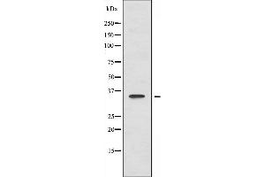 Western blot analysis of extracts from HUVEC cells, using ACOT8 antibody. (ACOT8 antibody  (Internal Region))