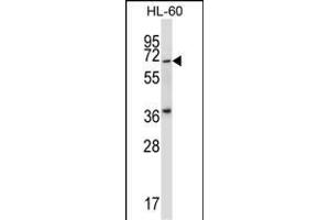 Mouse Pkmyt1 Antibody (N-term) (ABIN657999 and ABIN2846944) western blot analysis in HL-60 cell line lysates (35 μg/lane). (PKMYT1 antibody  (N-Term))