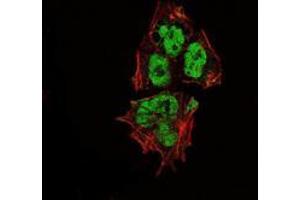 Immunofluorescence analysis of NTERA-2 cells using SOX2 mouse mAb (green). (SOX2 antibody)
