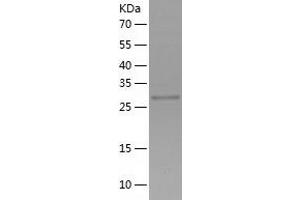 Western Blotting (WB) image for Vacuolar-sorting Protein SNF8 (SNF8) (AA 1-258) protein (His tag) (ABIN7288366) (SNF8 Protein (AA 1-258) (His tag))