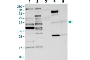 Western blot analysis of Lane 1: RT-4, Lane 2: U-251 MG, Lane 3: Human Plasma, Lane 4: Liver, Lane 5: Tonsil with CCDC34 polyclonal antibody  at 1:250-1:500 dilution.