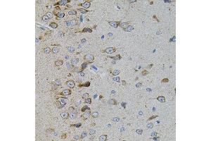 Immunohistochemistry of paraffin-embedded rat brain using MAPK11 antibody. (MAPK11 antibody)