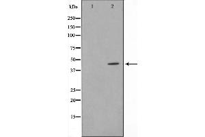 Western blot analysis on Jurkat cell lysate using AL2S7 Antibody,The lane on the left is treated with the antigen-specific peptide. (Cyclin-Dependent Kinase 15 (ALS2CR7) (Internal Region) antibody)