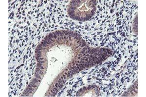 Immunohistochemical staining of paraffin-embedded Human endometrium tissue using anti-MIER2 mouse monoclonal antibody.