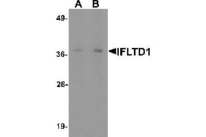 Western blot analysis of IFLTD1 in rat liver tissue lysate with IFLTD1 antibody at (A) 1 and (B) 2 µg/mL. (PAS1C1 antibody  (Middle Region))