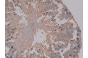 Detection of AMH in Rat Testis Tissue using Polyclonal Antibody to Anti-Mullerian Hormone (AMH) (AMH antibody  (AA 447-553))