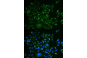 Immunofluorescence analysis of HeLa cells using BAMBI antibody (ABIN5973916). (BAMBI antibody)