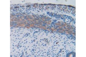 Used in DAB staining on fromalin fixed paraffin- embedded uterus tissue (FIL1d antibody  (AA 1-156))