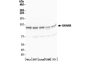 anti-Glucosidase, Alpha, Neutral AB (GANAB) (AA 200-250) antibody
