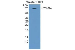 Detection of Recombinant C1qR1, Human using Polyclonal Antibody to Complement Component 1, Q Receptor (C1qR1) (CD93 antibody  (AA 227-493))
