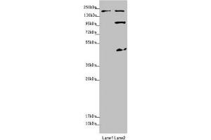 Western blot All lanes: MYO5B antibody at 1. (MYO5B antibody  (AA 1440-1690))