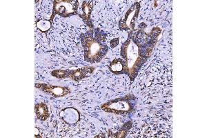 IHC analysis of TOM1L1 using anti-TOM1L1 antibody (ABIN7602631).