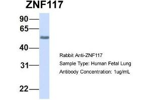 Host:  Rabbit  Target Name:  ZNF117  Sample Type:  Human Fetal Lung  Antibody Dilution:  1. (Zinc Finger Protein 117 antibody  (N-Term))
