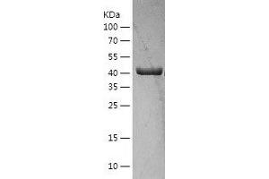 Western Blotting (WB) image for K(lysine) Acetyltransferase 2B (KAT2B) (AA 431-832) protein (His tag) (ABIN7123659) (KAT2B Protein (AA 431-832) (His tag))