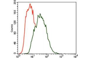 Immunohistochemical analysis of paraffin-embedded bladder cancer tissues using MARK3 antibody with DAB staining. (MARK3 antibody  (AA 435-658))