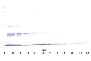 Image no. 2 for anti-Interleukin 20 (IL20) antibody (ABIN465437)