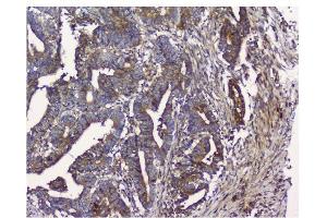 IHC analysis of NMI using anti-NMI antibody (ABIN3043451). (NMI antibody  (AA 2-307))