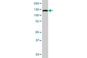 TYK2 monoclonal antibody (M01), clone 6G12 Western Blot analysis of TYK2 expression in HeLa . (TYK2 antibody  (AA 276-375))