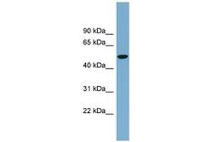 Image no. 1 for anti-Solute Carrier Family 2 (Facilitated Glucose Transporter) Member 8 (SLC2A8) (AA 323-372) antibody (ABIN6743220) (SLC2A8 antibody  (AA 323-372))