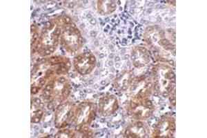 Immunohistochemistry (IHC) image for anti-Ankyrin Repeat Domain 54 (ANKRD54) (C-Term) antibody (ABIN1030482) (ANKRD54 antibody  (C-Term))
