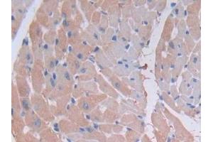 Detection of MYLK2 in Mouse Heart Tissue using Polyclonal Antibody to Myosin Light Chain Kinase 2 (MYLK2) (MYLK2 antibody  (AA 330-548))