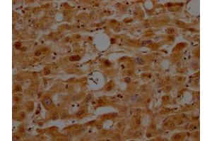 IHC image of ABIN7127348 diluted at 1:100 and staining in paraffin-embedded human liver tissue performed on a Leica BondTM system. (Recombinant ATF5 antibody)