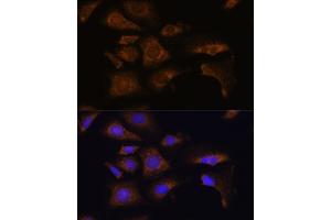 Immunofluorescence analysis of U-2 OS cells using RPS25 antibody (ABIN7270020) at dilution of 1:100. (RPS25 antibody  (C-Term))