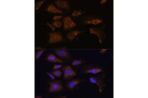 Immunofluorescence analysis of U-2 OS cells using RPS25 antibody (ABIN7270020) at dilution of 1:100.