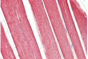 Human Skeletal Muscle: Formalin-Fixed, Paraffin-Embedded (FFPE) (TNNI2 antibody)