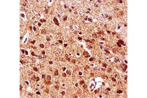 Gsk3b antibody immunohistochemistry analysis in formalin fixed and paraffin embedded mouse brain tissue. (GSK3 beta antibody  (AA 30-59))