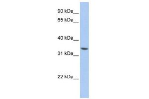 WB Suggested Anti-ZNF584 Antibody Titration:  0. (ZNF584 antibody  (Middle Region))