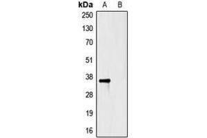 Western blot analysis of Anti-HSV-tag Antibody against HEK293T cells transfected with vector overexpressing HSV tag (A) and untransfected (B). (HSV Tag antibody)