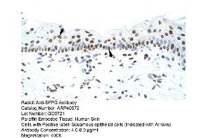 Rabbit Anti-SFPQ Antibody  Paraffin Embedded Tissue: Human Skin Cellular Data: Squamous epithelial cells Antibody Concentration: 4. (SFPQ antibody  (N-Term))