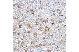 Immunohistochemistry of paraffin-embedded rat brain using EL Rabbit pAb (ABIN7266914) at dilution of 100 (40x lens). (ELAVL4 antibody  (AA 1-366))