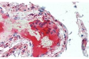 Immunohistochemistry (IHC) image for anti-Complement Component 5a (C5a) (AA 678-751) antibody (ABIN7442321)