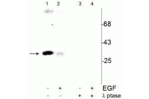 Western blot of human T47D cells showing specific immunolabeling of the ~34 kDa cdc2 phosphorylated at Tyr15 (Control, Lane 1). (CDK1 antibody  (pTyr15))