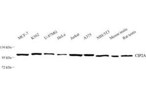 Western blot analysis of CIP2A (ABIN7074432) at dilution of 1: 500 (KIAA1524 antibody)