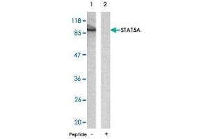 Western blot analysis of extracts from HeLa cells using STAT5A polyclonal antibody . (STAT5A antibody)
