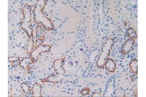 Figure. (c-MET antibody  (AA 1092-1379))