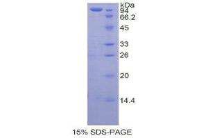 SDS-PAGE (SDS) image for Transglutaminase 2 (C Polypeptide, Protein-Glutamine-gamma-Glutamyltransferase) (TGM2) (AA 1-687) protein (His tag) (ABIN1081015)