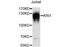 Western blot analysis of extracts of Jurkat cells, using KRI1 antibody (ABIN6294054) at 1:3000 dilution. (KRI1 antibody)