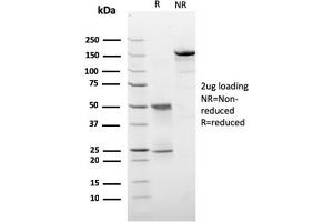 SDS-PAGE Analysis Purified HER-2 Monospecific Mouse Monoclonal Antibody (ERBB2/3257).