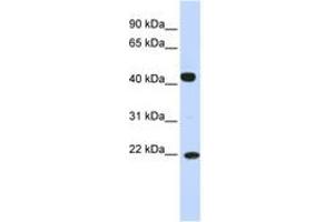 Image no. 1 for anti-Synovial Sarcoma, X Breakpoint 4 (SSX4) (N-Term) antibody (ABIN6742600) (SSX4 antibody  (N-Term))