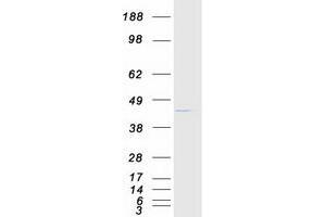 Western Blotting (WB) image for Cardiac Troponin T (cTnT) (Transcript Variant 1) protein (Myc-DYKDDDDK Tag) (ABIN2713175)