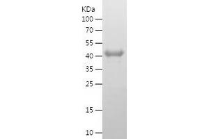 Western Blotting (WB) image for Meis Homeobox 3 (MEIS3) (AA 1-358) protein (His tag) (ABIN7283061) (MEIS3 Protein (AA 1-358) (His tag))