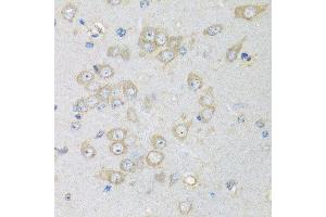 Immunohistochemistry of paraffin-embedded rat brain using CHMP1B antibody at dilution of 1:100 (x40 lens). (CHMP1B antibody)
