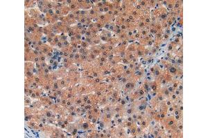 IHC-P analysis of liver tissue, with DAB staining. (LIFR antibody  (AA 45-184))