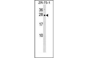 Western blot analysis of Interleukin-25 / IL25 Antibody (Center) in ZR-75-1 cell line lysates (35ug/lane). (IL-25 antibody  (Middle Region))